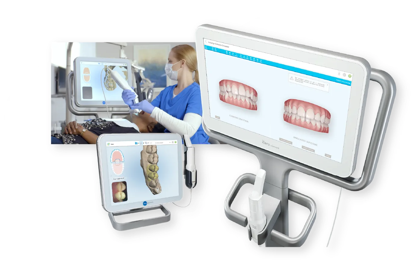 全国での導入数1%未満の最新口腔スキャナー